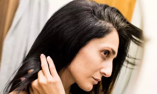 Hair Care : 30 के बाद ऐसे रखें बालों का खास ख्याल Hair Care : 30 के बाद ऐसे रखें बालों का खास ख्याल