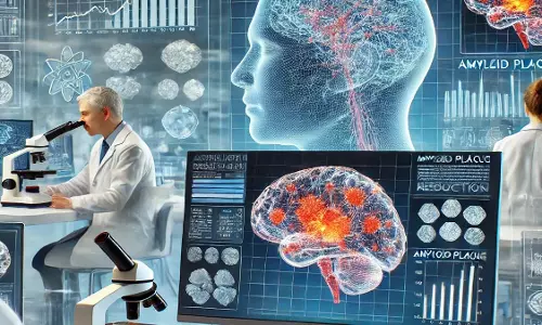 एंटी-अमाइलॉइड दवा अल्जाइमर डिमेंशिया को रोकने के संकेत दिखाती है- अध्ययन
