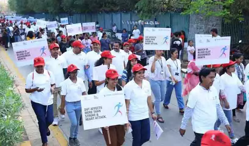 रोजाना टहलना रक्त के थक्के बनने से रोकने में फायदेमंद: Doctor रोजाना टहलना रक्त के थक्के बनने से रोकने में फायदेमंद: Doctor