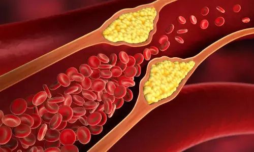 High Cholesterol से परेशान हैं? जानें, कैसे पाए छुटकारा