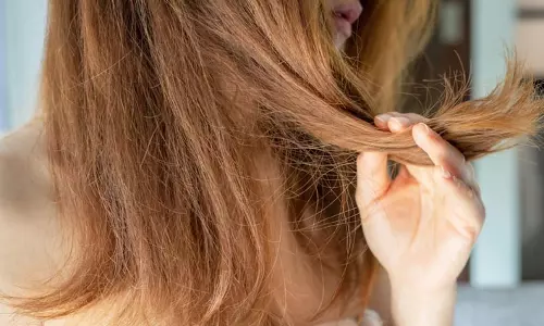 Hair Care: ज्यादा बाल झड़ने से आपके बाल हो रहे हैं डैमेज, तो हेयर केयर रूटीन में कॉफी का करें इस्तेमाल, होगा फायदा Hair Care: ज्यादा बाल झड़ने से आपके बाल हो रहे हैं डैमेज, तो हेयर केयर रूटीन में कॉफी का करें इस्तेमाल, होगा फायदा