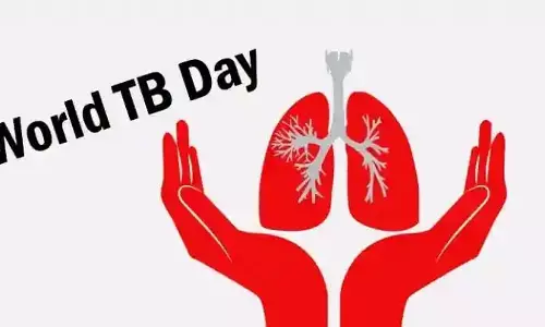 World TB Day 2025 : यूपी में 1300 से अधिक टीबी मुक्त ग्राम पंचायतें