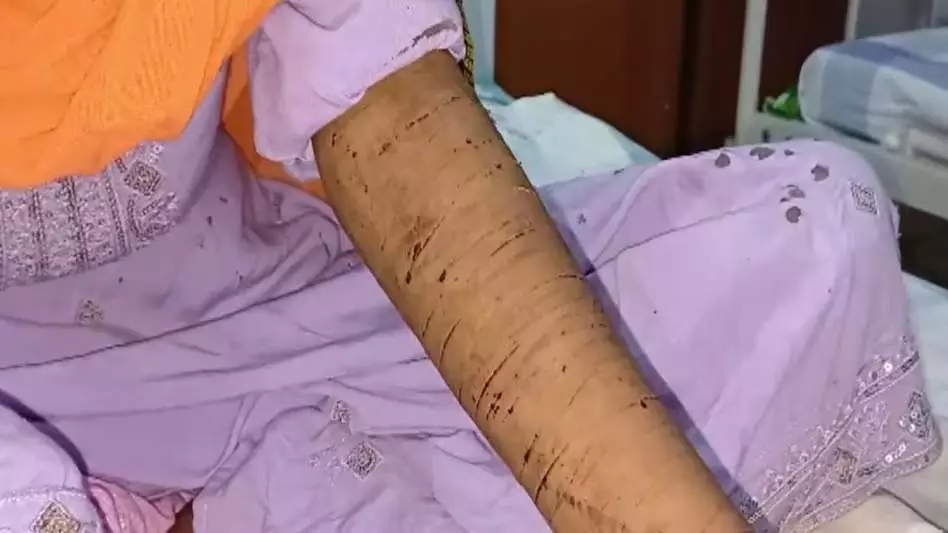 iPhone की डिमांड, नहीं मिलने पर युवती ने की खुदकुशी करने की कोशिश iPhone की डिमांड, नहीं मिलने पर युवती ने की खुदकुशी करने की कोशिश