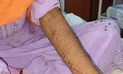 iPhone की डिमांड, नहीं मिलने पर युवती ने की खुदकुशी करने की कोशिश