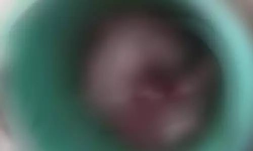 लाश मिली कचरा डिब्बे में, पुलिस पहुंची