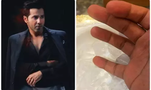 वरुण धवन घायल, शूटिंग के दौरान उंगली में लगी चोट