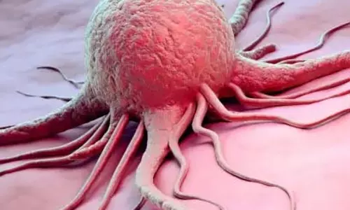 Cancer : जानें कैसे फैलता है शरीर में कैंसर