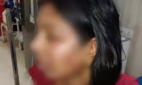 250 रुपए नहीं दिए तो पति ने पत्नी पर गर्म दाल झलका, गिरफ्तार