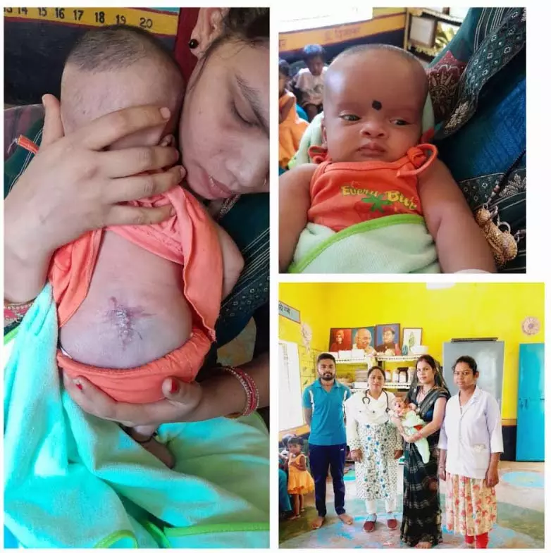 सर्जरी के बाद नन्ही सिद्धि पूरी तरह स्वस्थ, आयुष्मान योजना का मिला लाभ सर्जरी के बाद नन्ही सिद्धि पूरी तरह स्वस्थ, आयुष्मान योजना का मिला लाभ