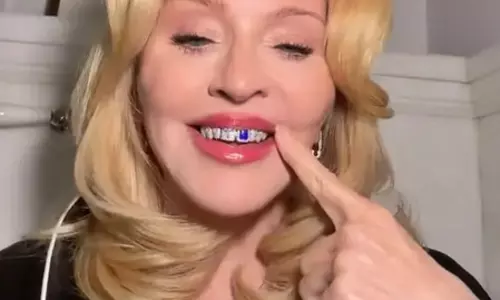 Madonna ने नए चमकदार माउथ ज्वेलरी पहने