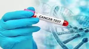 Science : सिर्फ 11 हजार रुपए में होगा कैंसर का इलाज, चीन ने बनाई नई थेरेपी Science : सिर्फ 11 हजार रुपए में होगा कैंसर का इलाज, चीन ने बनाई नई थेरेपी