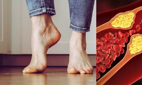 Cholesterol बढ़ने से पैरों में होने वाली समस्याएं