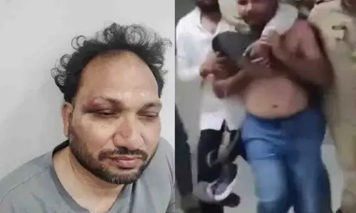पत्रकार ने Bandi Sanjay के गुर्गों पर हमला करने का आरोप लगाया