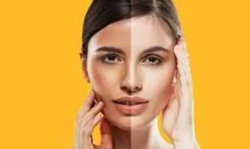 Akine Care: गर्मियों में टैनिंग से हैं परेशान, तो लगाएं ये फेस पैक