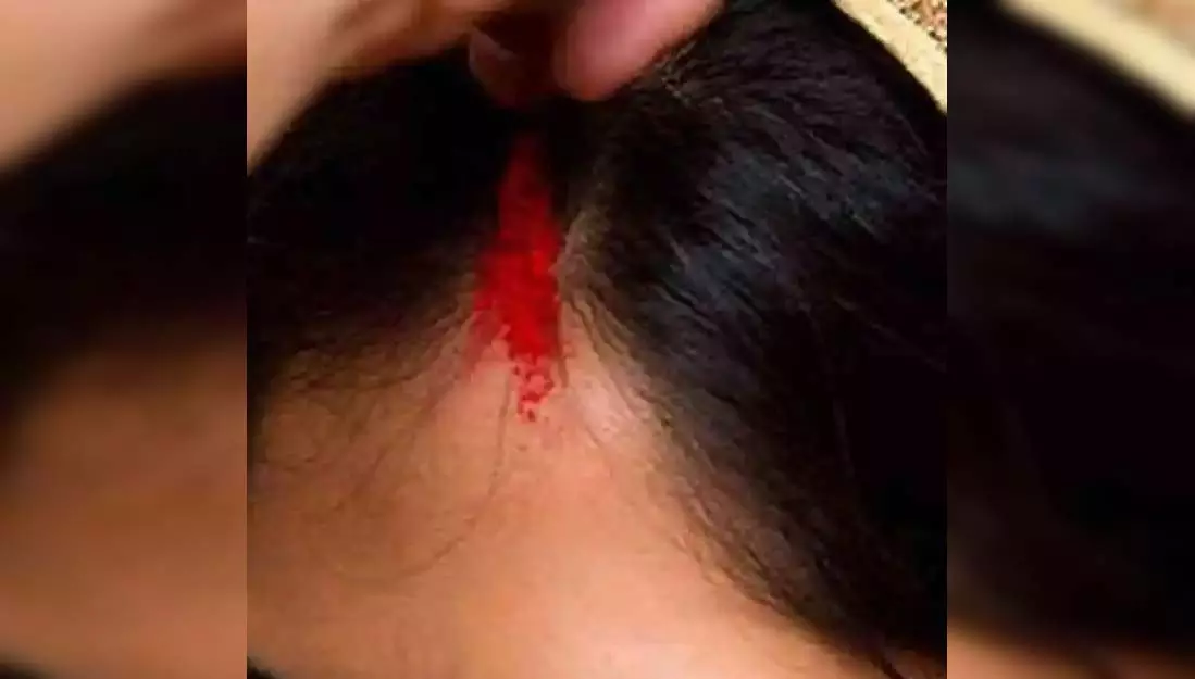 सिरफिरे की करतूत, नाबालिग लड़की को सड़क पर जबरन रोककर मांग में सिंदूर भरा सिरफिरे की करतूत, नाबालिग लड़की को सड़क पर जबरन रोककर मांग में सिंदूर भरा
