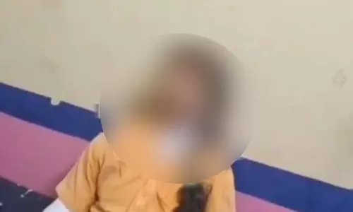 BJP नेता की बेटी पर एसिड अटैक, सीसीटीवी फुटेज सामने आया, विपक्ष भड़का