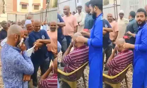 Hyderabad: नाई के ‘बालों को फिर से उगाने वाले लोशन’ ने गंजे लोगों को अस्पताल पहुंचाया Hyderabad: नाई के ‘बालों को फिर से उगाने वाले लोशन’ ने गंजे लोगों को अस्पताल पहुंचाया