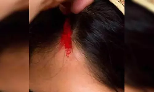 सिरफिरे की करतूत, नाबालिग लड़की को सड़क पर जबरन रोककर मांग में सिंदूर भरा