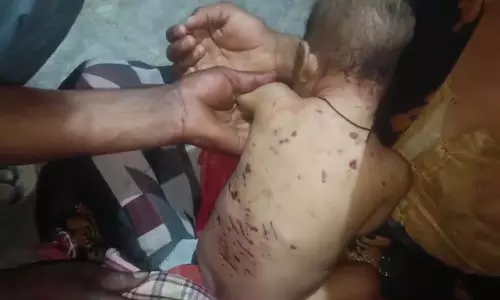 Farrukhabad: आवारा कुत्तों के हमले में पांच महीने के बच्चे की दर्दनाक मौत Farrukhabad: आवारा कुत्तों के हमले में पांच महीने के बच्चे की दर्दनाक मौत