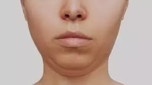 Beauty Tips: 30 दिन में पाएं डबल चिन से छुटकारा, रोजाना करें ये 4 फेशियल एक्सरसाइज Beauty Tips: 30 दिन में पाएं डबल चिन से छुटकारा, रोजाना करें ये 4 फेशियल एक्सरसाइज