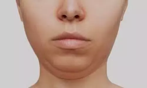 Beauty Tips: 30 दिन में पाएं डबल चिन से छुटकारा, रोजाना करें ये 4 फेशियल एक्सरसाइज Beauty Tips: 30 दिन में पाएं डबल चिन से छुटकारा, रोजाना करें ये 4 फेशियल एक्सरसाइज
