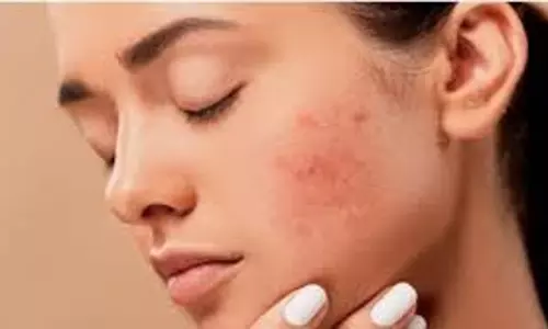 Skin care: चेहरे की सफाई के बाद गलती से भी न करें ये काम, वरना त्वचा पर आने लगेंगे पिंपल्स Skin care: चेहरे की सफाई के बाद गलती से भी न करें ये काम, वरना त्वचा पर आने लगेंगे पिंपल्स