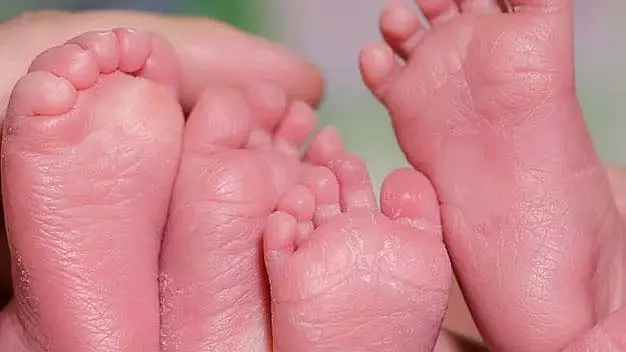 भोपाल में महिला ने समय से पहले चार बच्चों को दिया जन्म; शिशुओं का वजन 1 किलो से कम भोपाल में महिला ने समय से पहले चार बच्चों को दिया जन्म; शिशुओं का वजन 1 किलो से कम
