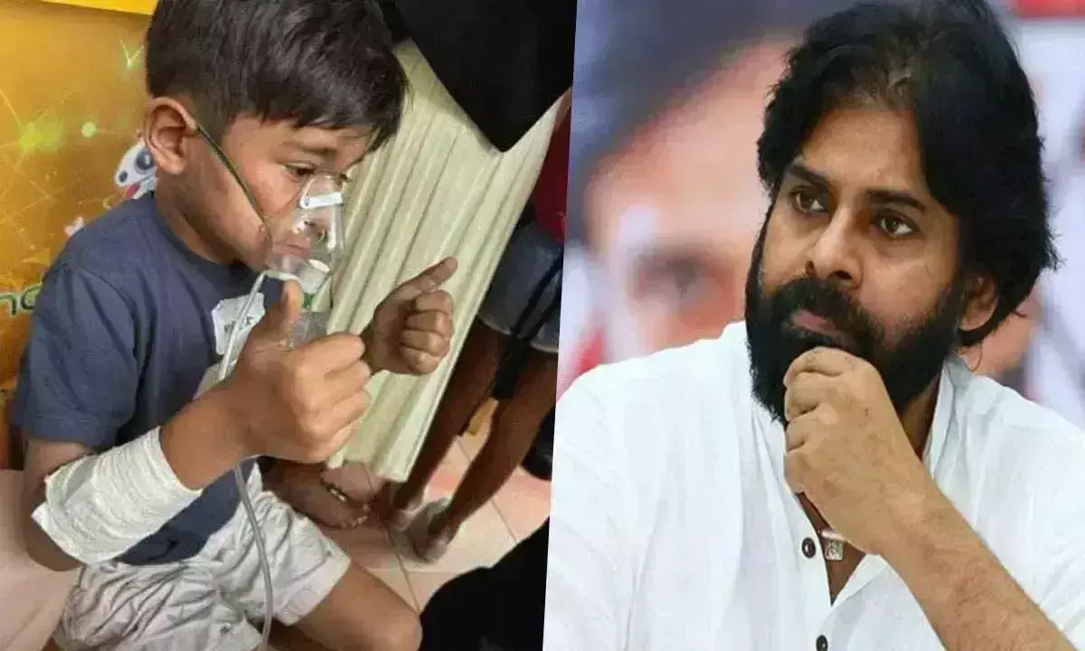 Andhra: पवन के बेटे मार्क शंकर सिंगापुर के एक अस्पताल में स्वास्थ्य लाभ ले रहे हैं