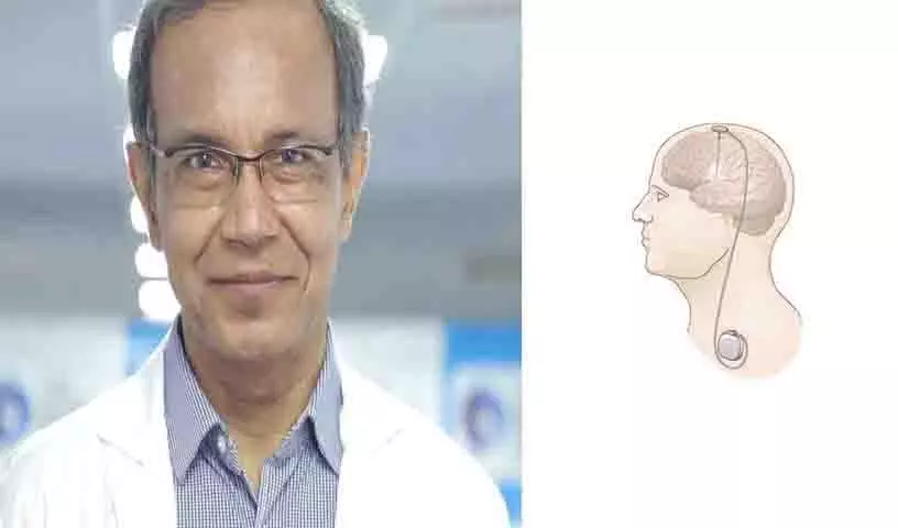 Hyderabad: मस्तिष्क का पेसमेकर तंत्रिका संबंधी विकारों के लिए नई उम्मीद की किरण Hyderabad: मस्तिष्क का पेसमेकर तंत्रिका संबंधी विकारों के लिए नई उम्मीद की किरण