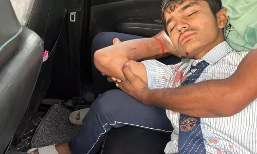 Raebareli: स्कूल जाते छात्र पर धारदार हथियार से हमला