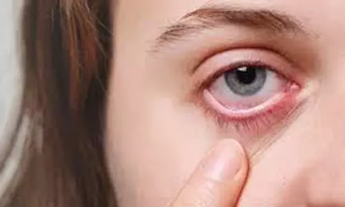Health: लू से आंखों को हो सकता है बड़ा नुकसान, जानिए गर्मियों में कैसे रखें ख्याल