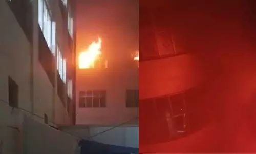 Lucknow: सीएम योगी ने लोकबंधु अस्पताल में आग की घटना पर अधिकारियों से ली जानकारी