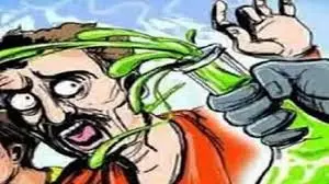 Bareilly: तेजाब हमले में युवती की भूमिका, बरेली में एक युवक झुलसा, जांच शुरू Bareilly: तेजाब हमले में युवती की भूमिका, बरेली में एक युवक झुलसा, जांच शुरू