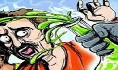 Bareilly: तेजाब हमले में युवती की भूमिका, बरेली में एक युवक झुलसा, जांच शुरू