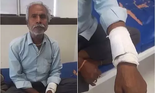 बेटा घायल: पिता की गलती से हो गई सर्जरी बेटा घायल: पिता की गलती से हो गई सर्जरी