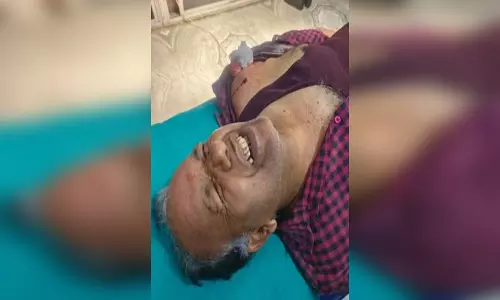 अपराधियों ने जेवर दुकान के मालिक को मारी गोली, फैली सनसनी अपराधियों ने जेवर दुकान के मालिक को मारी गोली, फैली सनसनी