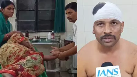 समस्तीपुर में महिला समेत चार लोगों पर एसिड से हमला, पुलिस ने शुरू की जांच समस्तीपुर में महिला समेत चार लोगों पर एसिड से हमला, पुलिस ने शुरू की जांच