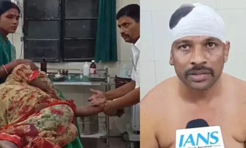 समस्तीपुर में महिला समेत चार लोगों पर एसिड से हमला, पुलिस ने शुरू की जांच