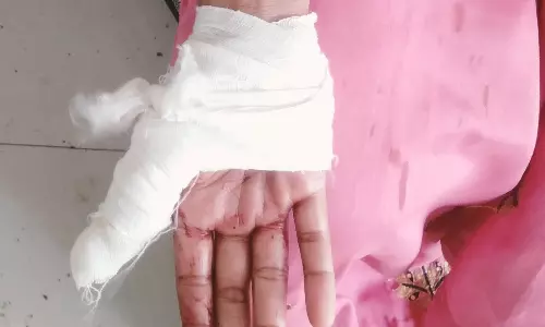 Noida: नशे की हालत में क्रूरता, पत्नी की उंगली दांतों से काटी Noida: नशे की हालत में क्रूरता, पत्नी की उंगली दांतों से काटी