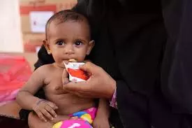 कुपोषण ने यमन संकट को और बढ़ाया, एनजीओ को आशंका भविष्य में स्थिति होगी भयावह कुपोषण ने यमन संकट को और बढ़ाया, एनजीओ को आशंका भविष्य में स्थिति होगी भयावह