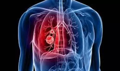 Health: कमजोर फेफड़ों को मजबूत और स्वस्थ बनाते हैं ये योगासन