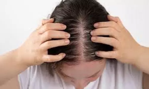 Hair Care: आपके बाल झड़ने लगे हैं तो लगाएं इस बीज से बना हेयर पैक Hair Care: आपके बाल झड़ने लगे हैं तो लगाएं इस बीज से बना हेयर पैक