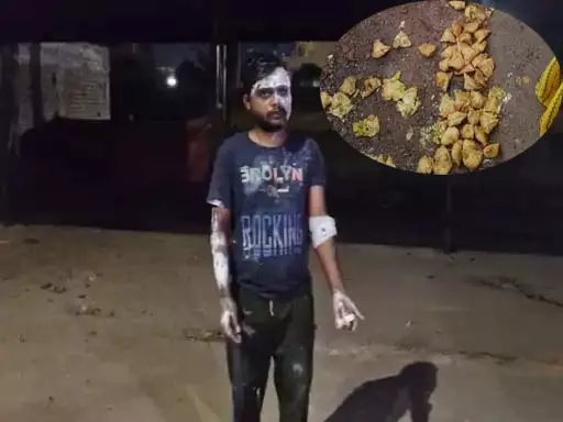 वसूली कर रहा था नशेड़ी युवक, विरोध कर रहे समोसा वाले पर डाला गर्म तेल वसूली कर रहा था नशेड़ी युवक, विरोध कर रहे समोसा वाले पर डाला गर्म तेल