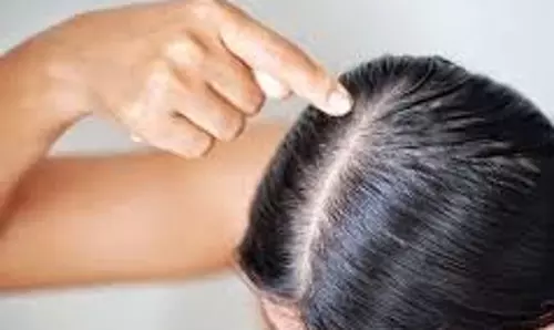 Hair Care Tips: जानिए  बालों की देखभाल में काली चाय का कमाल, चमत्कारी फायदे