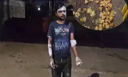 वसूली कर रहा था नशेड़ी युवक, विरोध कर रहे समोसा वाले पर डाला गर्म तेल वसूली कर रहा था नशेड़ी युवक, विरोध कर रहे समोसा वाले पर डाला गर्म तेल