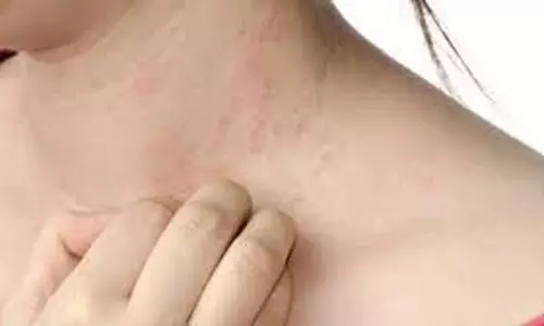 Skin Care Tips: गर्मियों में स्किन रैशेज और पिंपल्स से हैं परेशान तो एलोवेरा में मिलाकर लगाएं ये चीजें Skin Care Tips: गर्मियों में स्किन रैशेज और पिंपल्स से हैं परेशान तो एलोवेरा में मिलाकर लगाएं ये चीजें