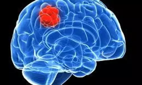 Health: जानिए ब्रेन ट्यूमर होने पर शरीर में क्या लक्षण दिखते हैं, कैसे करें इसकी पहचान