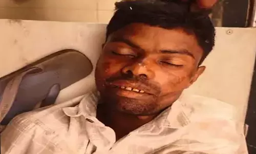 शिक्षक समेत 4 लोग हादसे का शिकार, एक की मौत