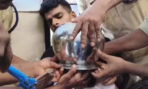 अग्निशमन कर्मियों ने दो साल की बच्ची को बचाया जिसका सिर बर्तन में फंस गया अग्निशमन कर्मियों ने दो साल की बच्ची को बचाया जिसका सिर बर्तन में फंस गया