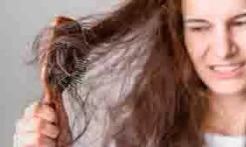 Hair Care Tips: बाल हो जाते हैं उलझे, ऐसे रखें अपने बालों का ख्याल Hair Care Tips: बाल हो जाते हैं उलझे, ऐसे रखें अपने बालों का ख्याल